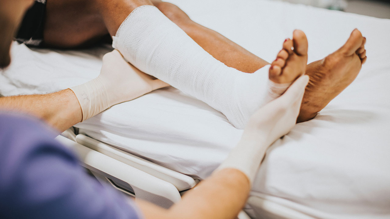 woman in ER with bandaged leg