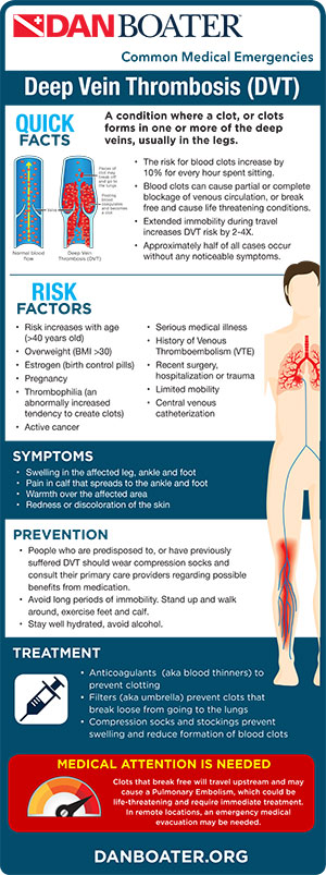 Infographic on Deep Vein Thrombosis