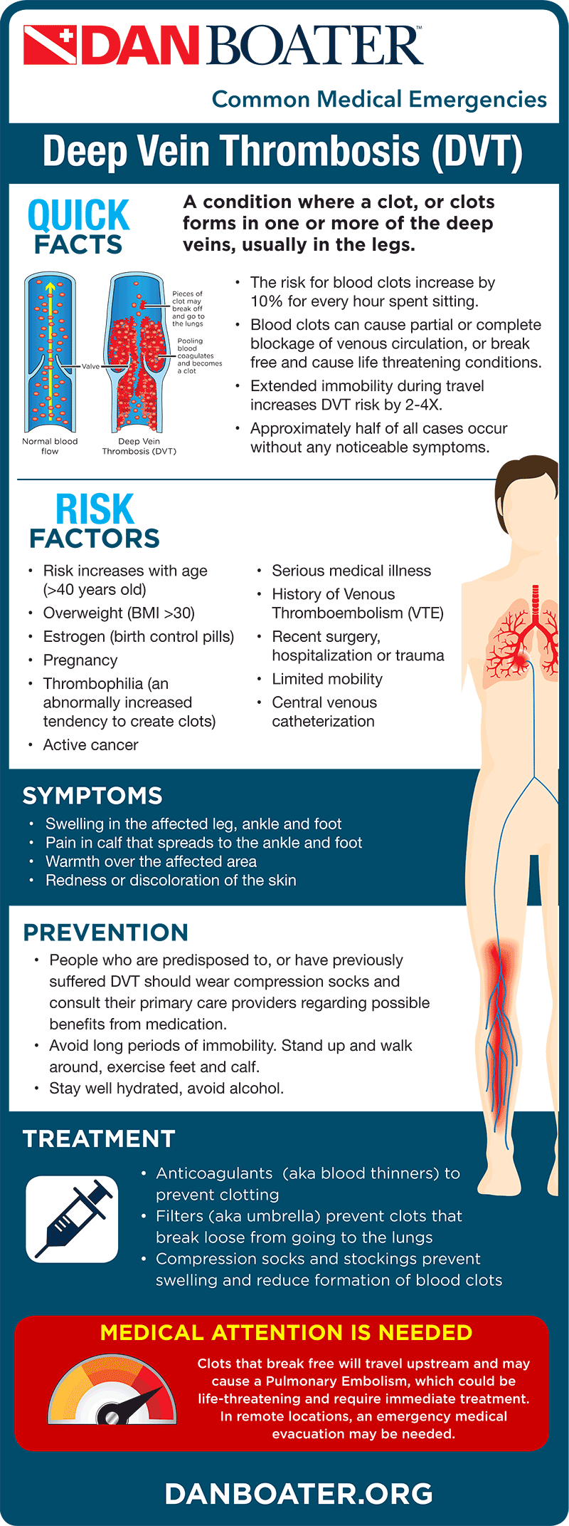 Medical Compression and Deep Vein Thrombosis (DVT) - Vein