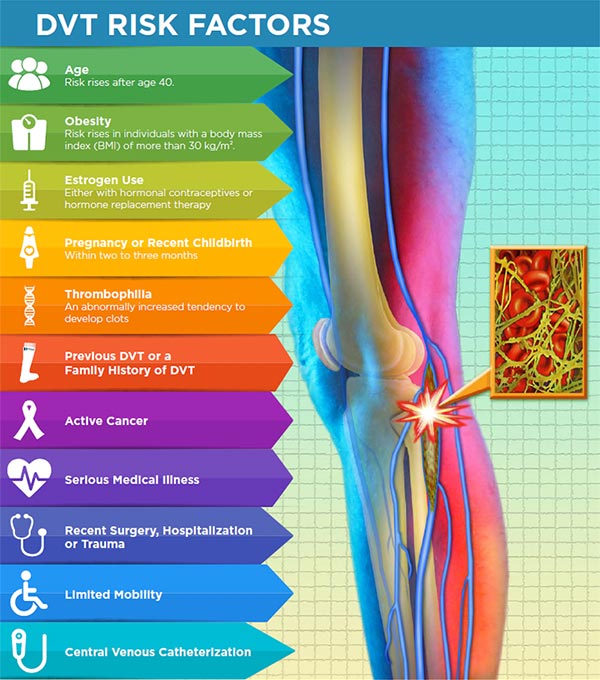 infographic of DVT Risk Factors