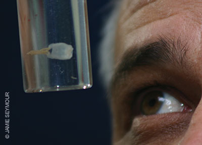 tiny box jellyfish responsible for Irukandji Syndrome